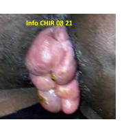 Atlas De Diagnostic Chirurgicale (ADC) - Chirurgie Gynécologique