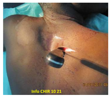 Atlas De Diagnostic Chirurgicale (ADC) - Neurochirurgie